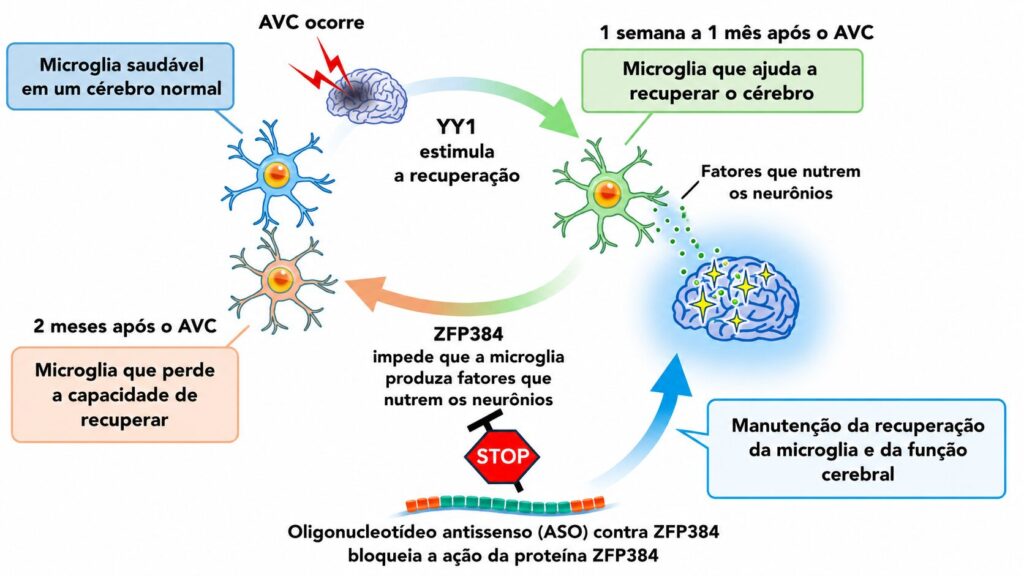 AVC